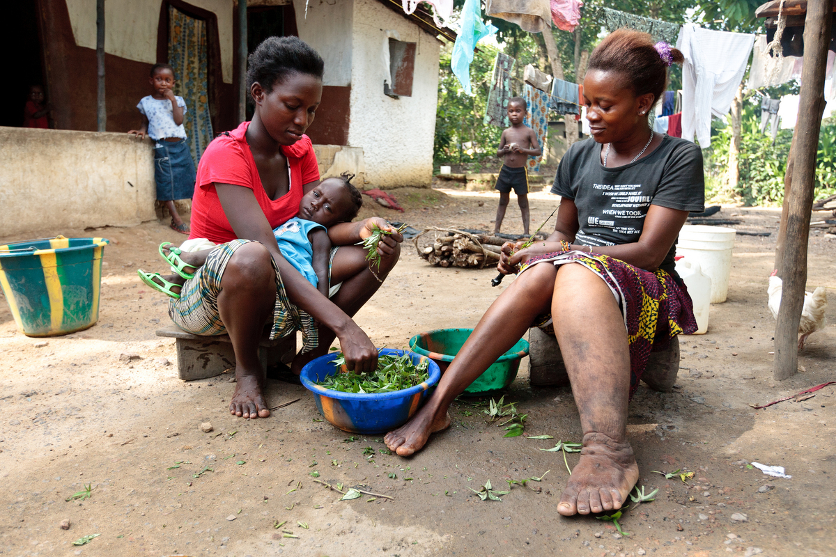Lymphatic Filariasis or Elephantiasis symptom